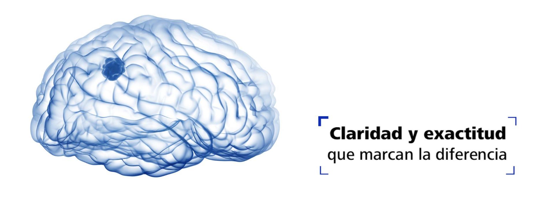 Modernidad en visualización en Neurocirugía: Fluorescencia Intraoperatoria YELLOW 560