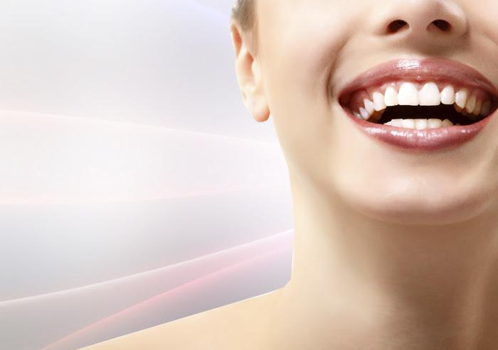 Aclaramiento Dental