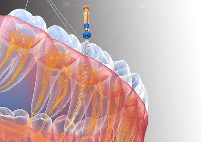 Curso on line  “Decidiendo qué sistema mecanizado utilizar basado en conocimientos científicos y tecnológicos”