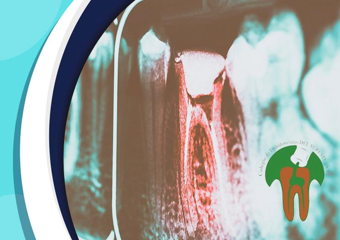 Evaluación tridimensional en alta resolución para endodoncia