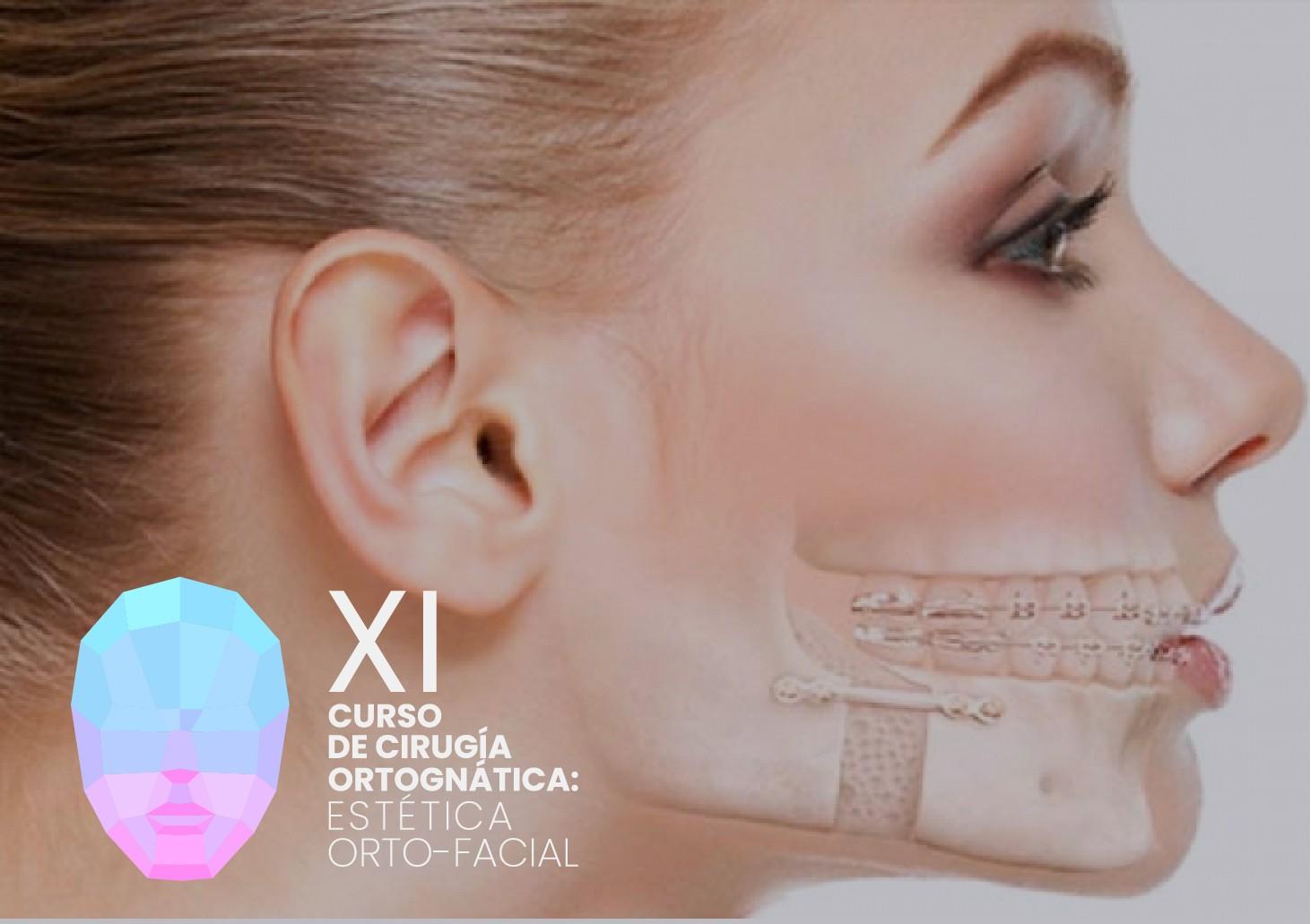 XI CURSO DE CIRUGÍA ORTOGNÁTICA: ESTÉTICA ORTO FACIAL 