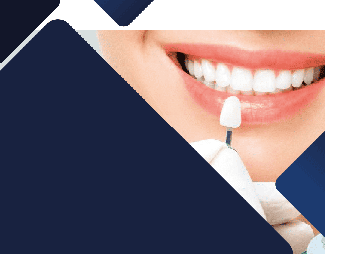 Curso Gratuito: Biomecánica avanzada en Rehabilitación Oral
