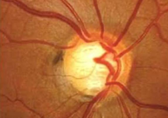 Curso VIRTUAL Internacional