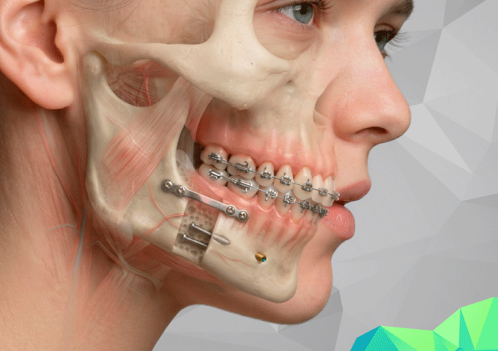 XIV CURSO DE CIRUGÍA ORTOGNÁTICA: ESTÉTICA ORTO-FACIAL