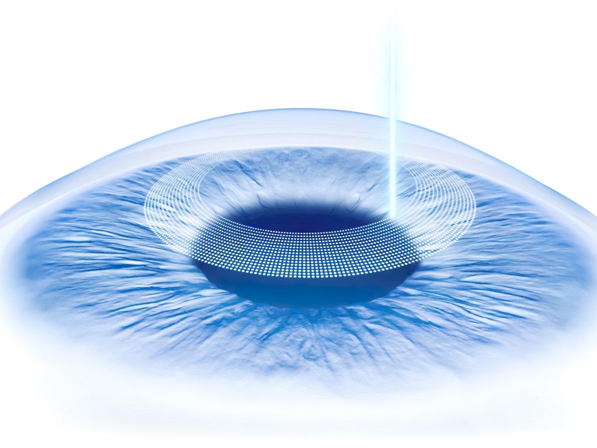 ZEISSVISUMAX 800 Wetlabs Experience | XXXI Curso Internacional de Córnea y Cirugía Refractiva 2026
